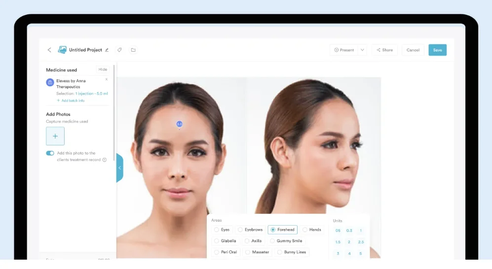 Face mapping tool Pabau