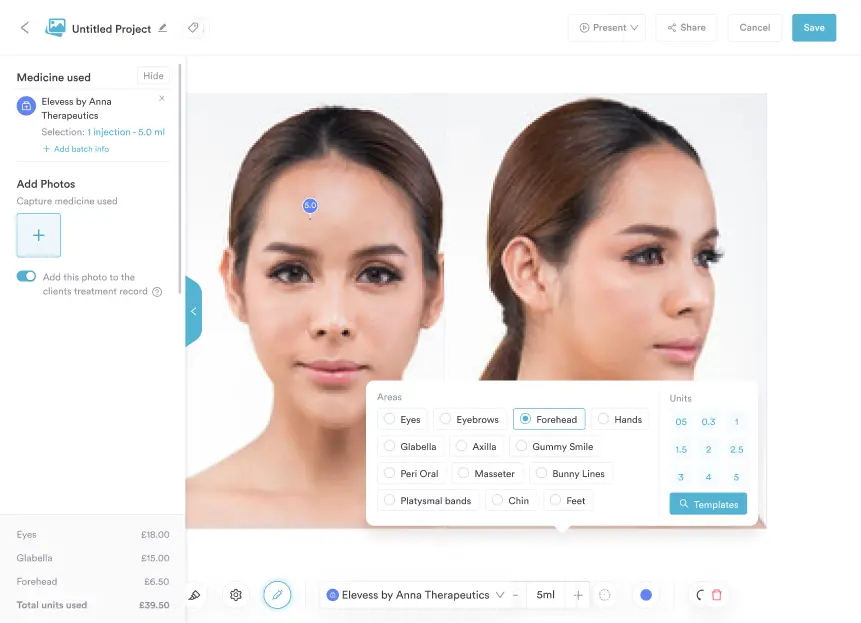 Pabau before and after photography tool
