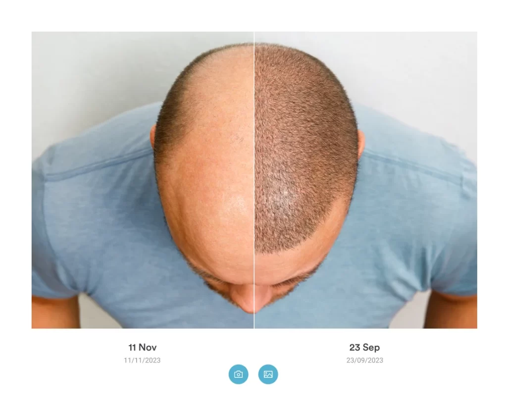 Before and after image Pabau