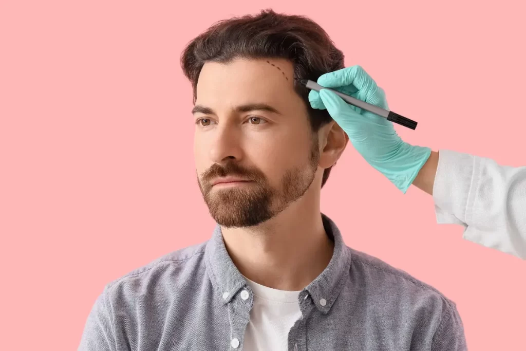 Hair restoration marketing strategies to grow your practice