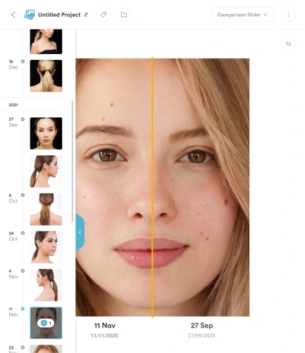 Image showing the before and after feature in Pabau