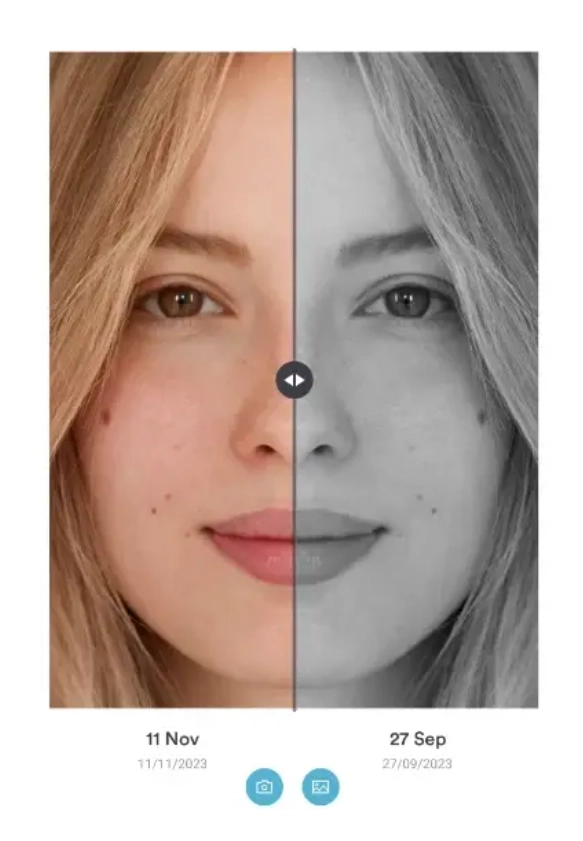 Pabau before and after photo comparison tool with side-by-side dermatology treatment results and automated client consent workflows