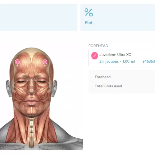 Precise unit tracking