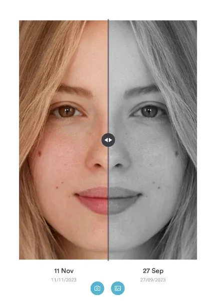 Before-and-after photos in Pabau 2