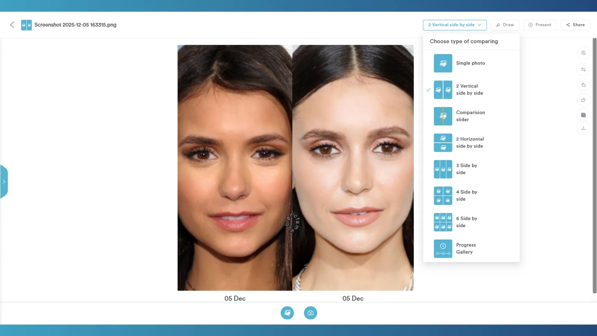 Before & After Photo Management