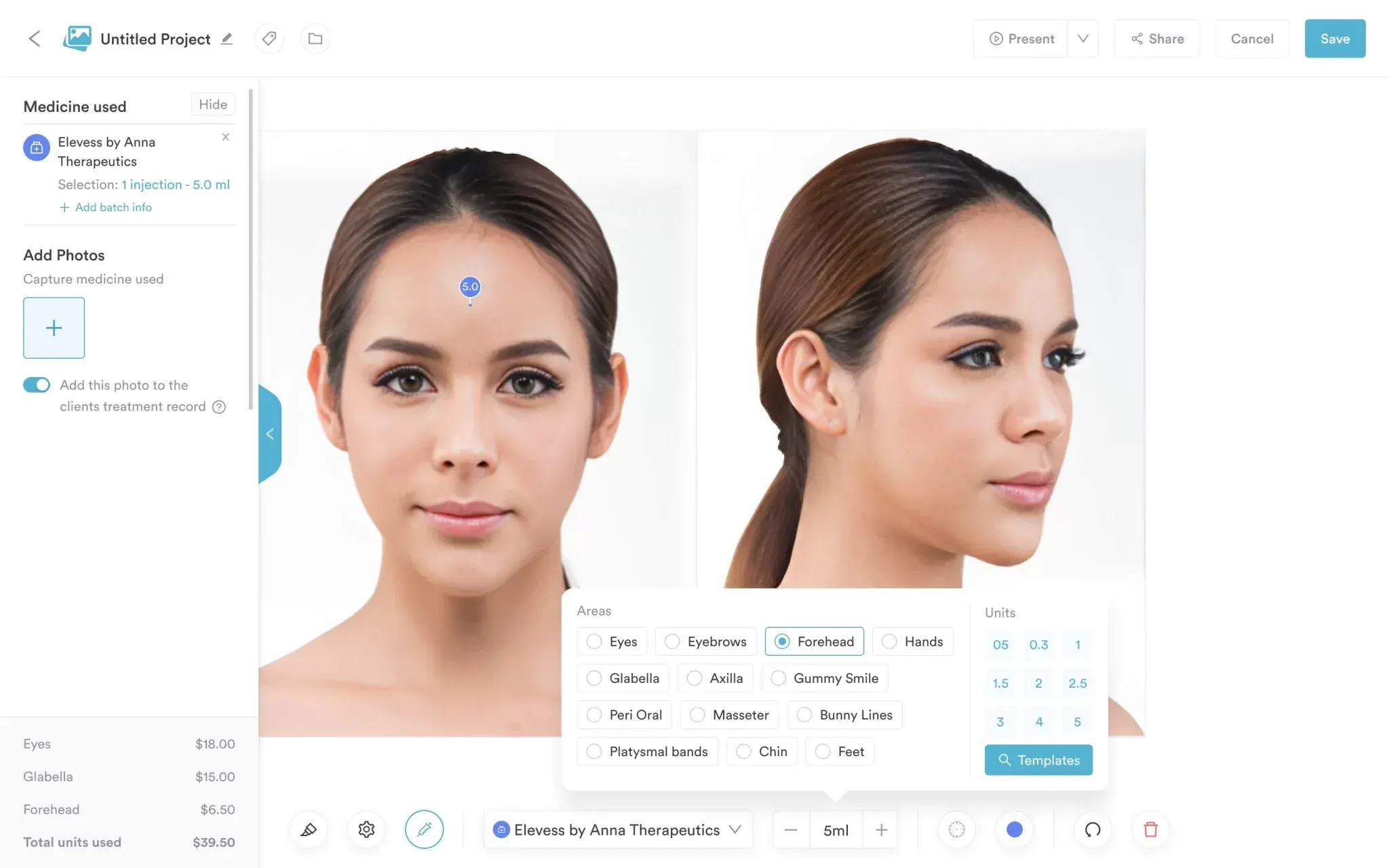 Injection-plotting-Pabau